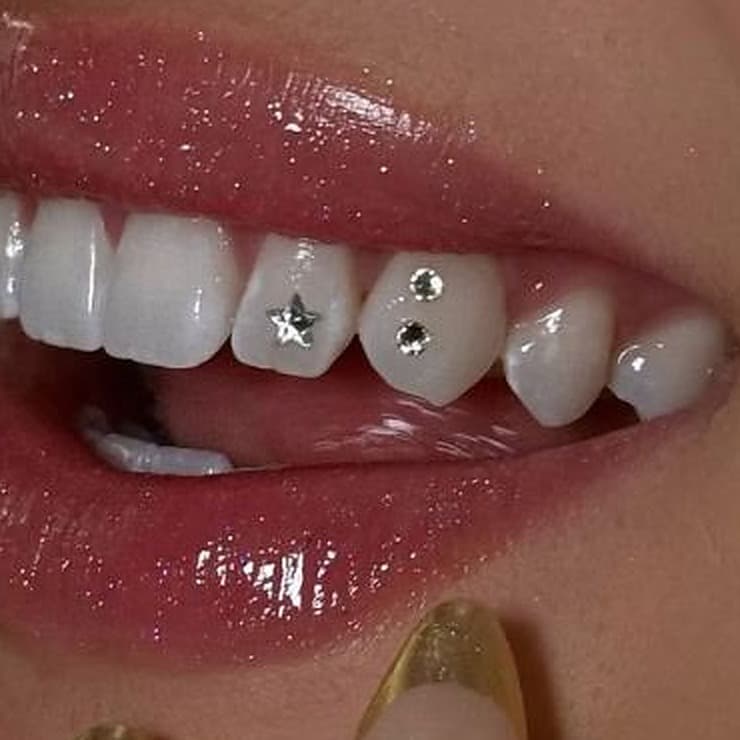 A silver star and two crystal tooth gems on the upper teeth